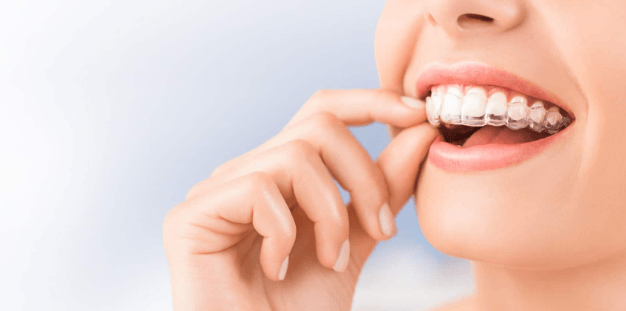 How Technology Is Enhancing Invisalign Results In Brisbane